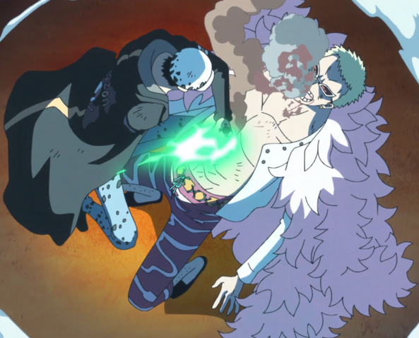 File:Gamma Knife.png