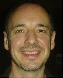 Wiki stephen