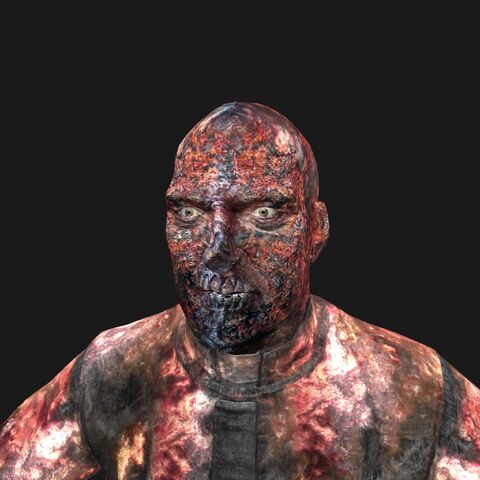 File:ArchimbaudBurnedFace.jpeg