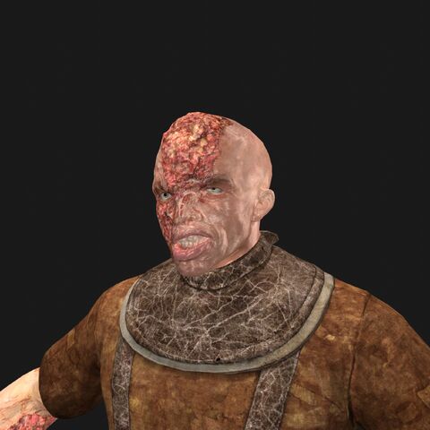 File:Patient2 faceA.jpeg