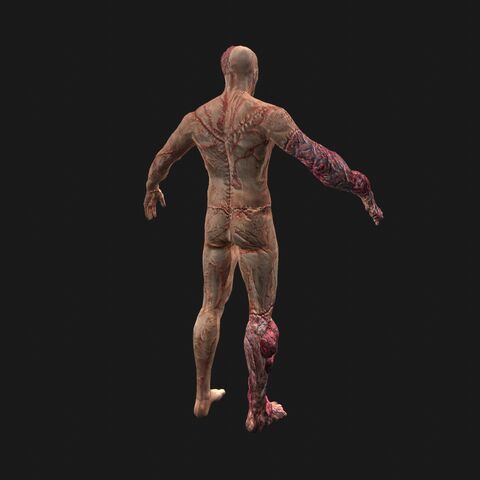 File:Patient14 perspBack.jpeg