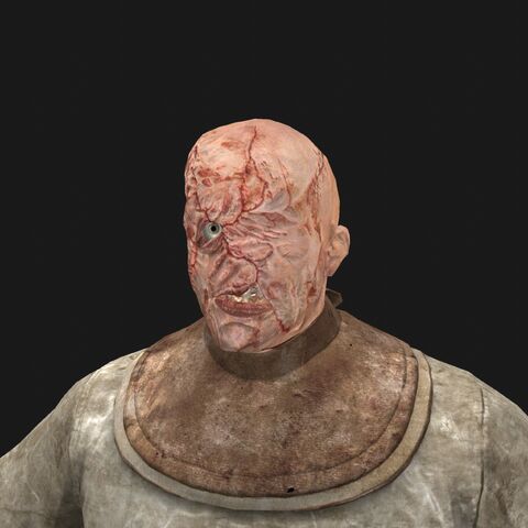 File:Patient8 face.jpeg