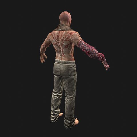 File:Patient3 perspBack.jpeg