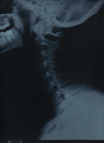 File:Cervical coloumn.png