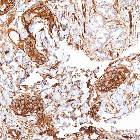 File:CD34.EHE.7.jpg