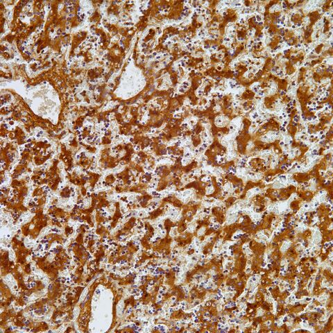 File:Copy of AFP.fetal liver.jpg