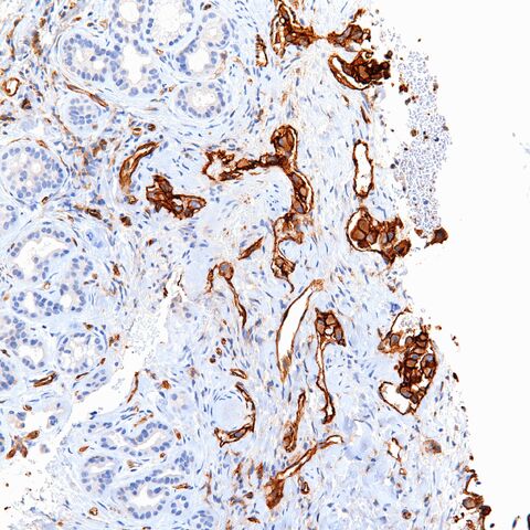 File:CD31.EHE.7.jpg