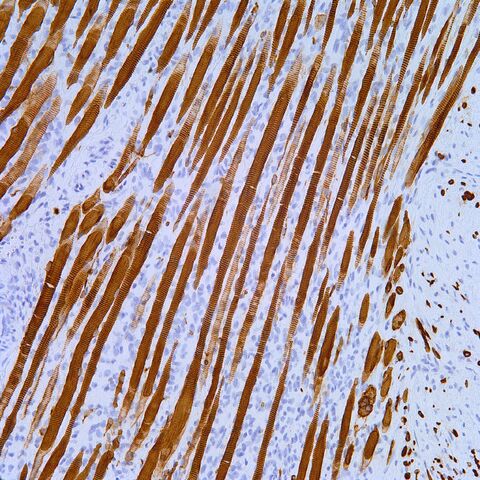 File:Desmin.skeletal muscle striations.200x.jpg