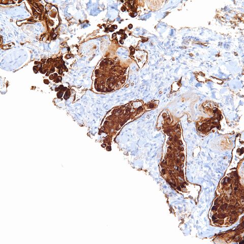 File:Factor 8 assoc ag.EHE.2.jpg
