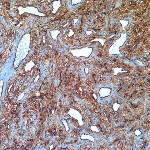 File:CD34.SFT.1.jpg