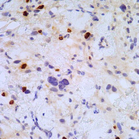 File:Myogenin.mast cells.400x.2.jpg