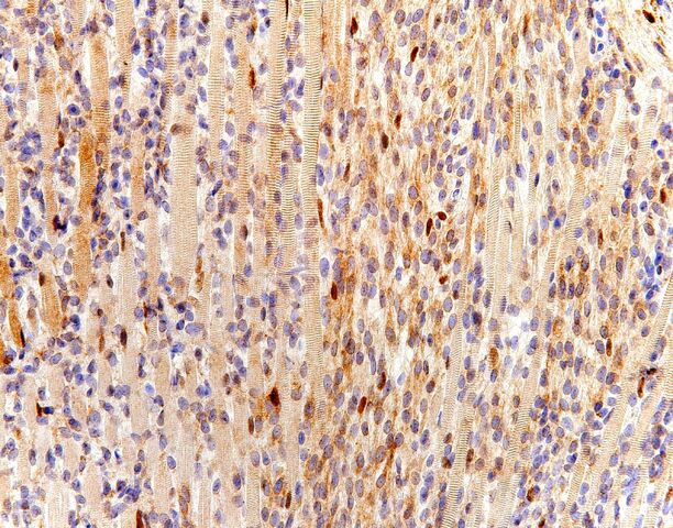 File:MyoD1.entrapped skeletal muscle.200x.jpg
