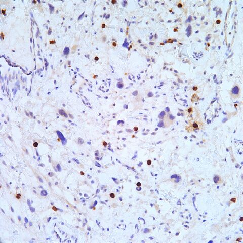 File:Myogenin.mast cells.200x.1.jpg
