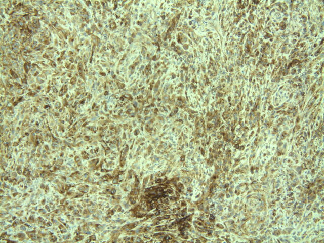 File:SMB2 GLUT-1.jpg