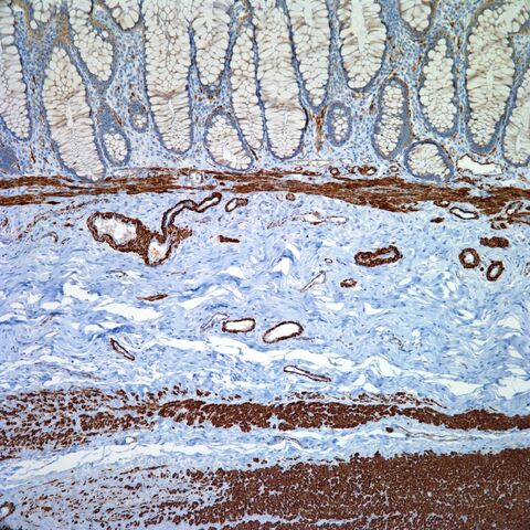 File:MSA.colon.jpg