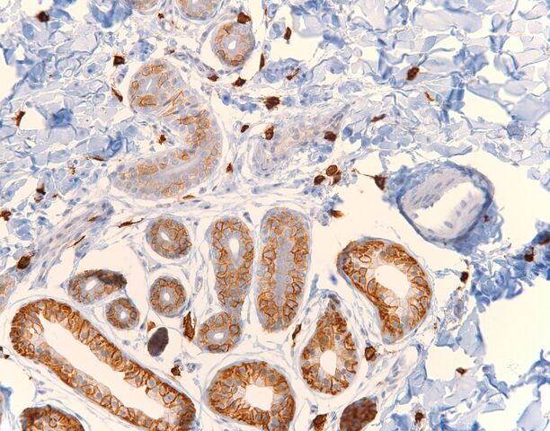 File:CD117.eccrine coil.mast cells.200x.jpg