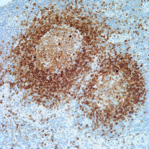 File:CD79a.lymph node.2.jpg