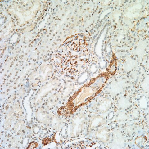 File:SMA.glomerulus.kidney.jpg