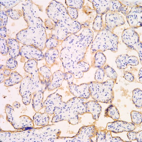 File:PLAP.placenta.jpg