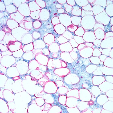 File:S100.red.adipose tissue.200x.jpg