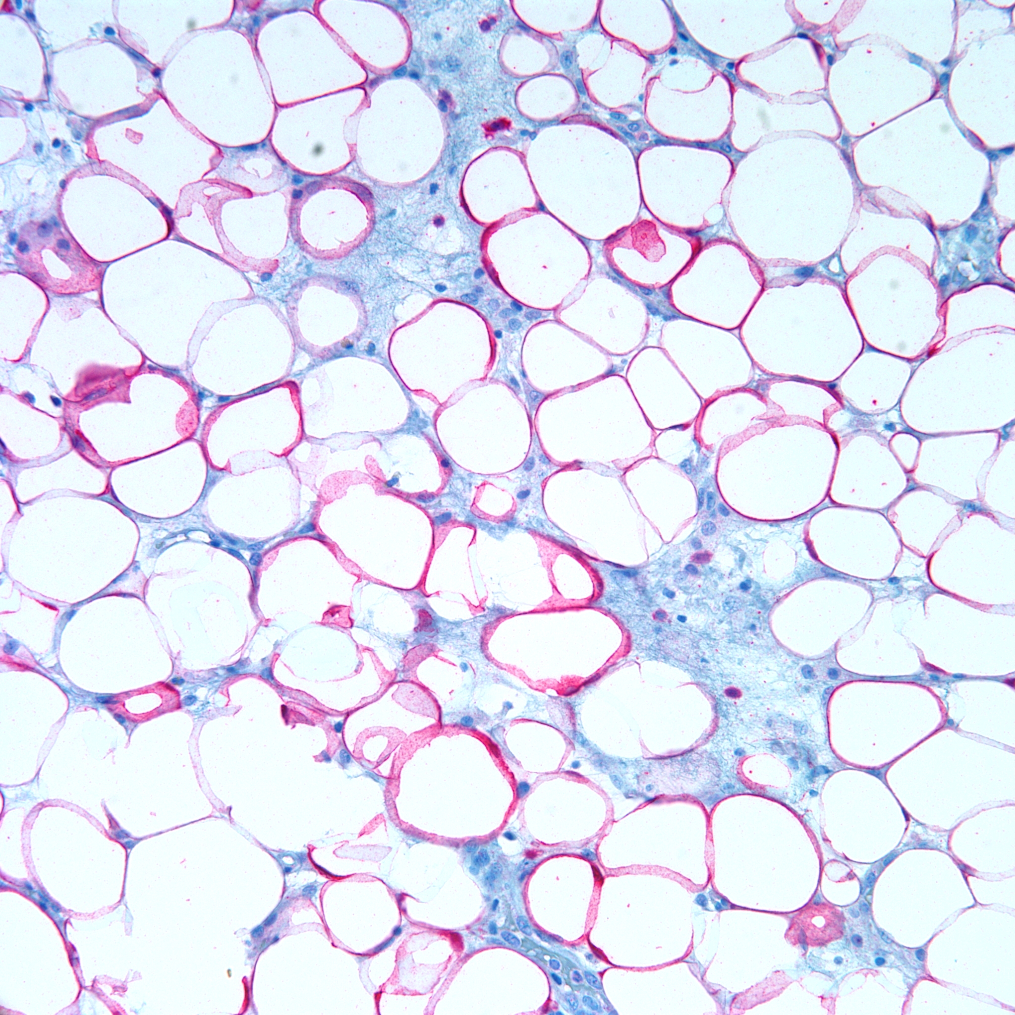 Adipose tissue jacques science