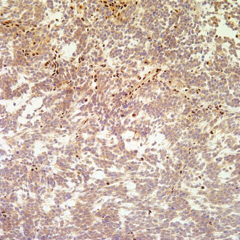 File:INI-1.MERT.5.jpg