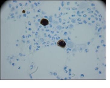 ParvoIHC