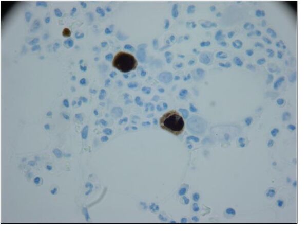 File:ParvoIHC.jpg