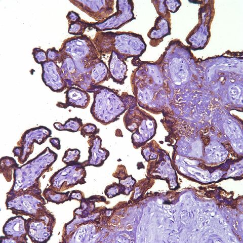 File:PLAP.placenta.1.jpg