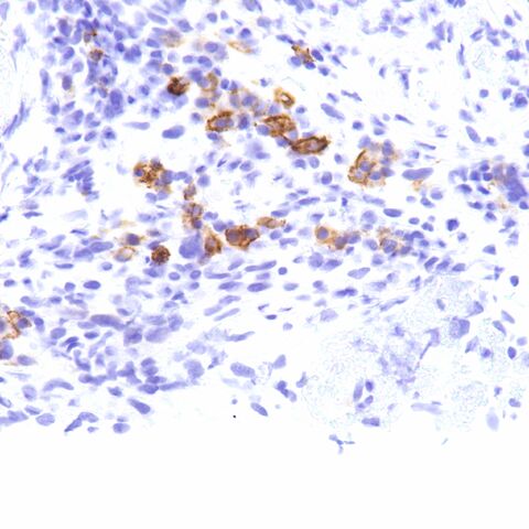 File:EMA.plasma cells.1.jpg