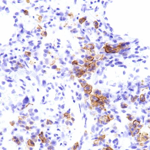File:EMA.plasma cells.2.jpg