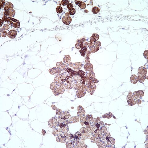File:AE1 3.parotid.2.jpg
