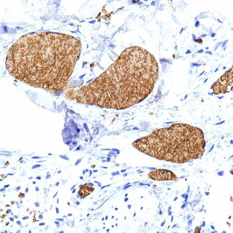 File:GLUT-1.RBC.400x.jpg