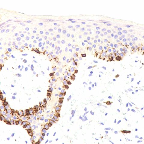 File:CD117.melanocytes.400x.jpg