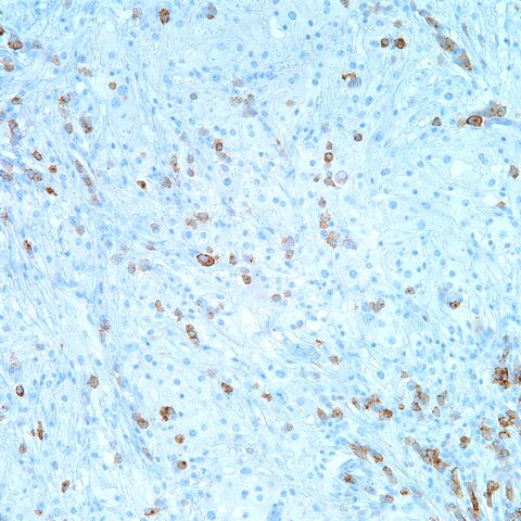 File:EMA.plasma cells.4.jpg