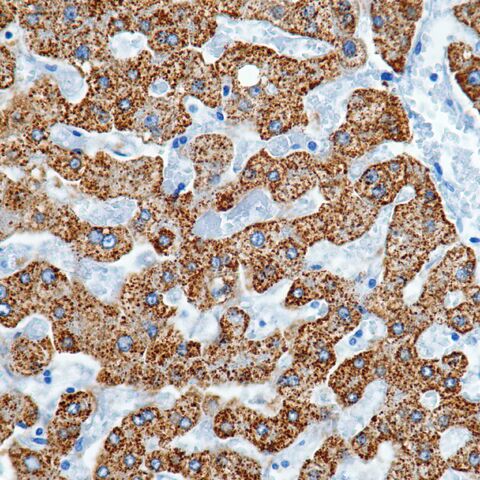 File:Heppar1.liver.1.jpg