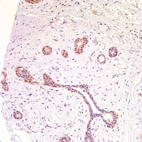 File:Sox10.breast myoepithelial.jpg