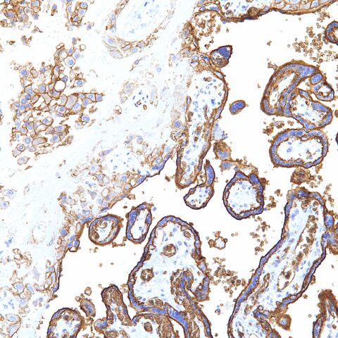 File:GLUT-1.placenta.200x.jpg
