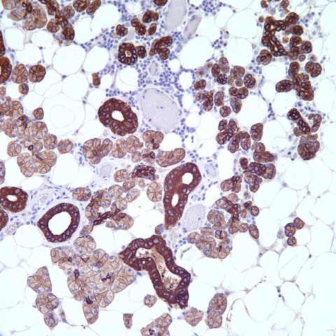 File:AE1 3.parotid.3.jpg