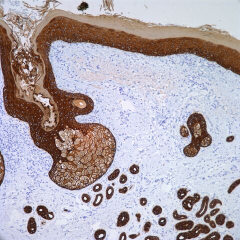 File:AE1.AE3 Cytokeratin Skin.jpg