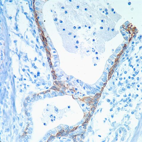 File:CK5-6.normal prostate.400x.jpg