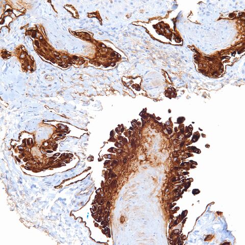 File:Factor 8 assoc ag.EHE.3.jpg