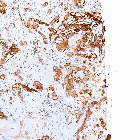 File:CD31.EHE.4.jpg