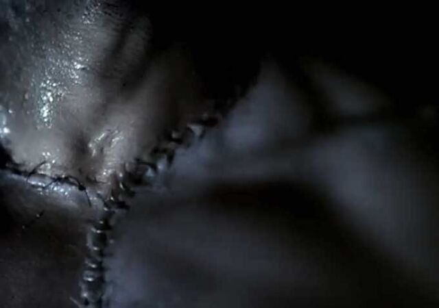 File:Stitches.jpg