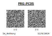 PRG PCOS
