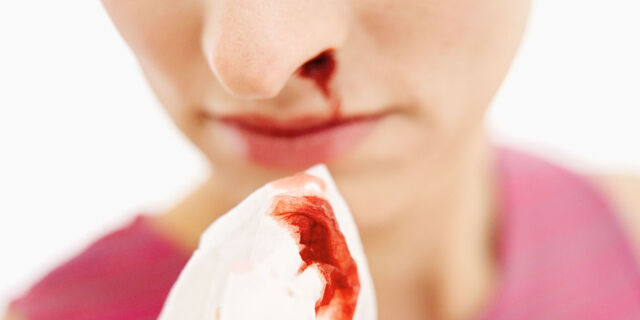 File:Nosebleed.jpg