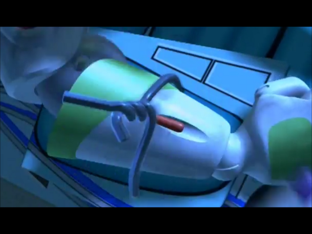 File:Snapshot 1 (31-12-2011 15-21).png
