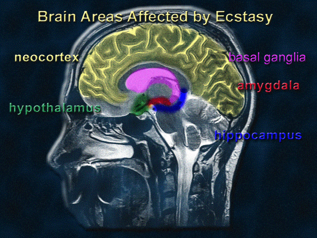 File:Eslide6.gif