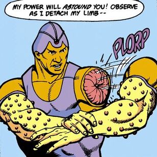 File:Armfalloffboy.jpg