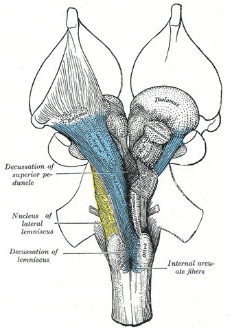 File:Gray690.png